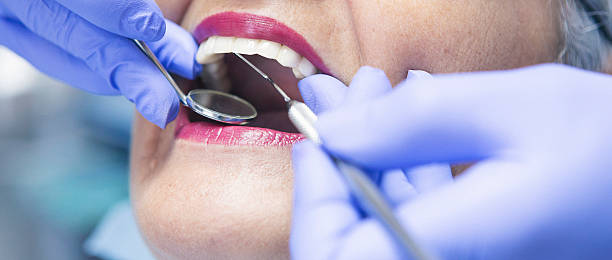 Best Urgent Dental Care for Toothaches in Reed Creek, GA