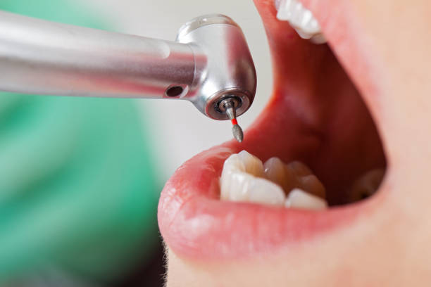 Best Emergency Treatment for Jaw Pain or Injury in Reed Creek, GA